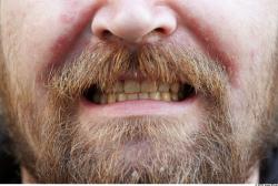 Teeth Man White Overweight Bearded